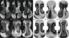 Thumbnail: Figure 7. Refer to the following caption and surrounding text.